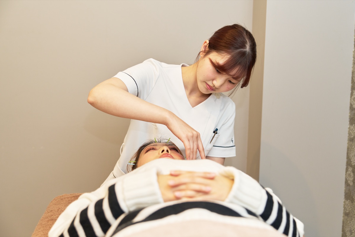 美容鍼の施術（お顔への鍼）